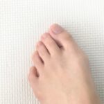 外反母趾に悩む方のイメージ 中井スポーツ整骨院