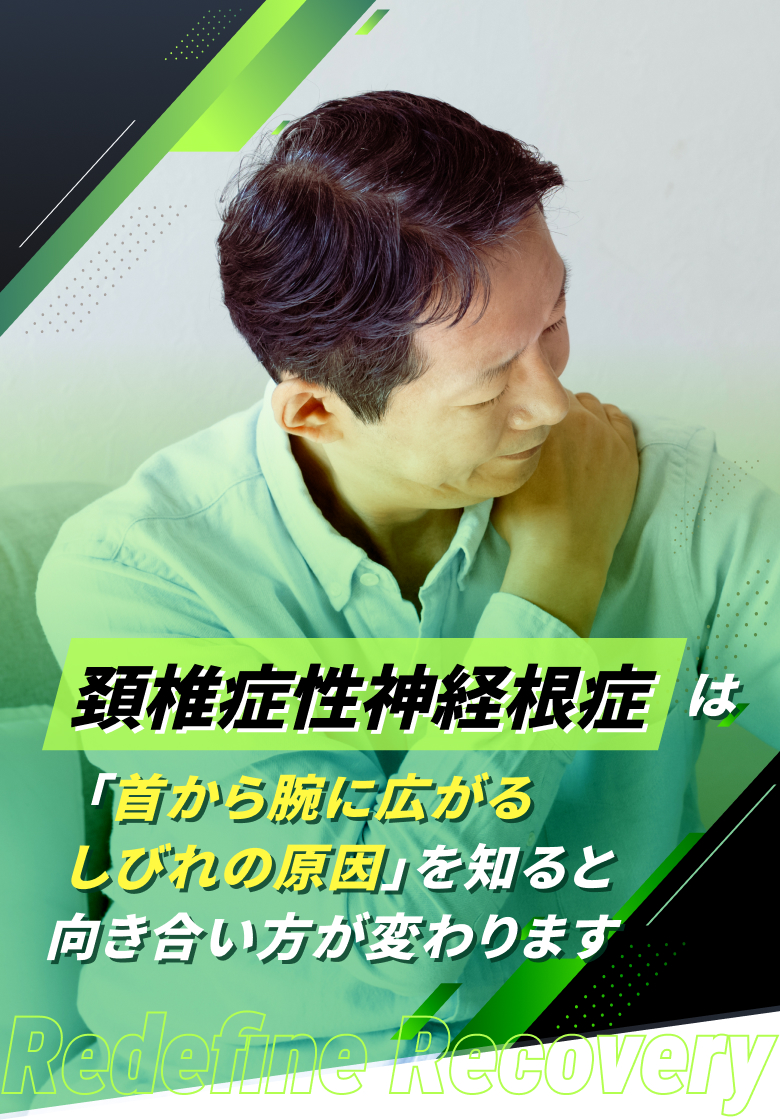 頚椎症性神経根症(しびれを伴う頚部痛)