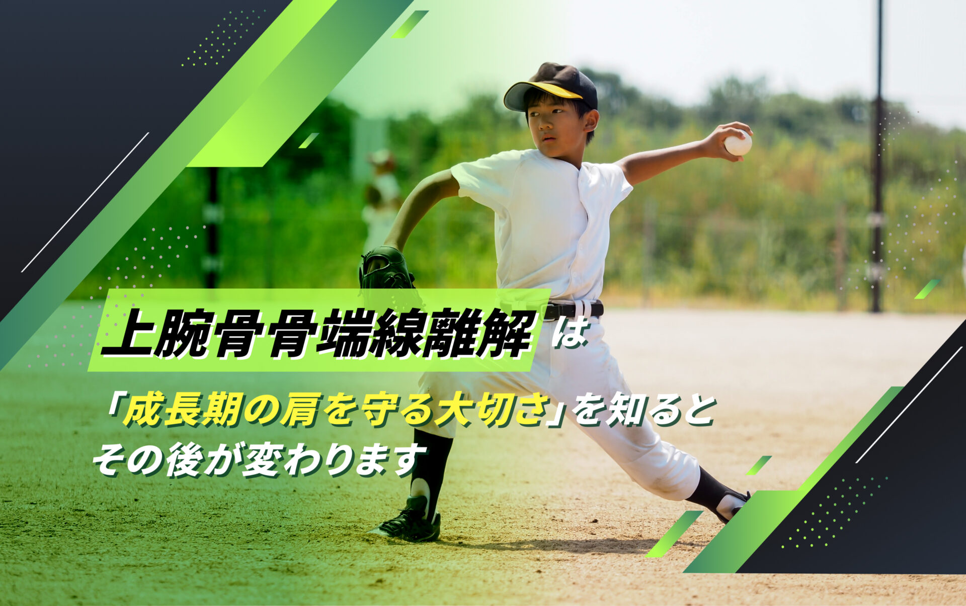 上腕骨骨端線離解(リトルリーガーズ・ショルダー)