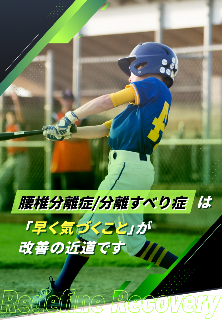 腰椎分離症/分離すべり症