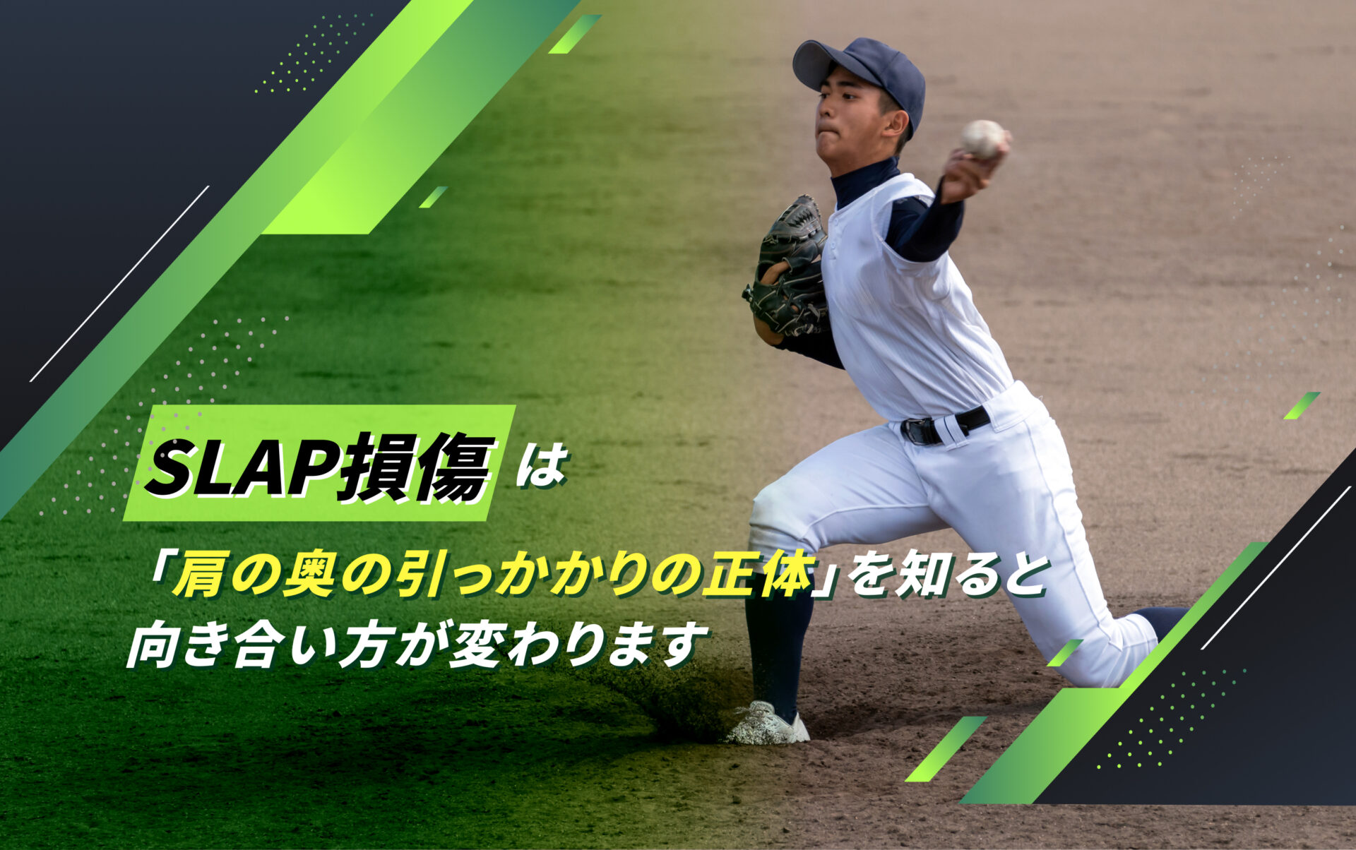 SLAP損傷(上方関節唇損傷)