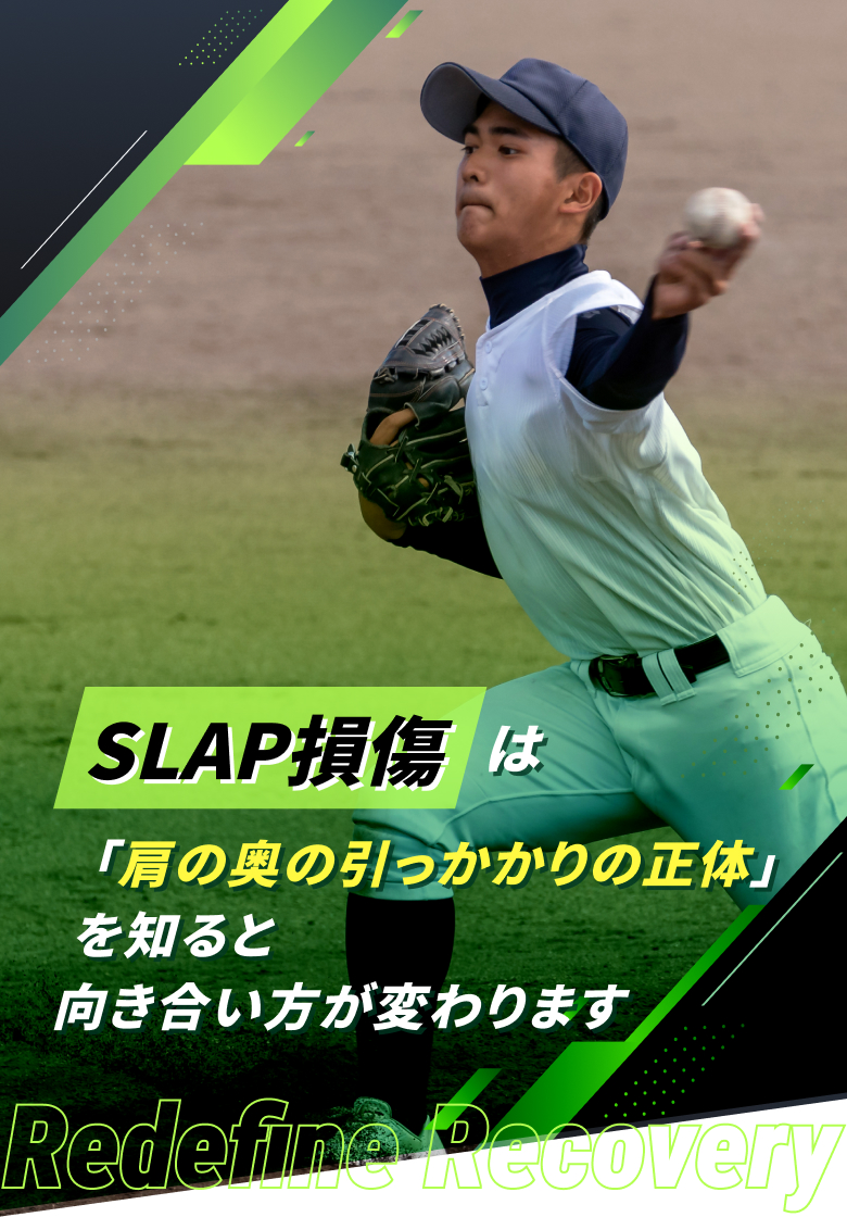 SLAP損傷(上方関節唇損傷)
