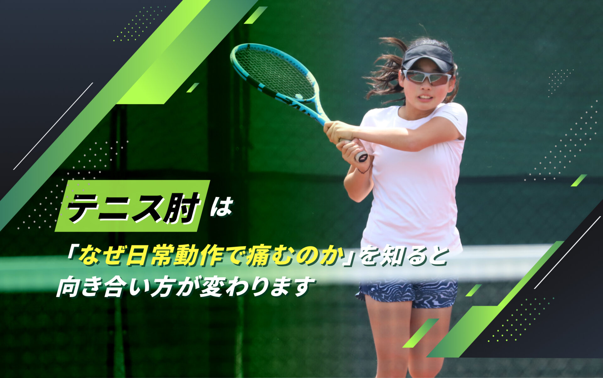 テニス肘(上腕骨外側上顆炎)