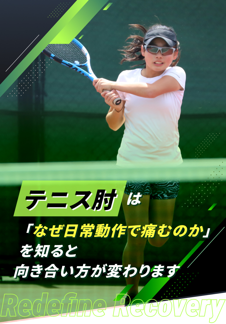 テニス肘(上腕骨外側上顆炎)