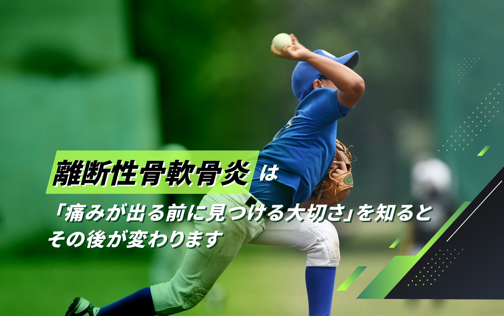 離断性骨軟骨炎（OCD）
